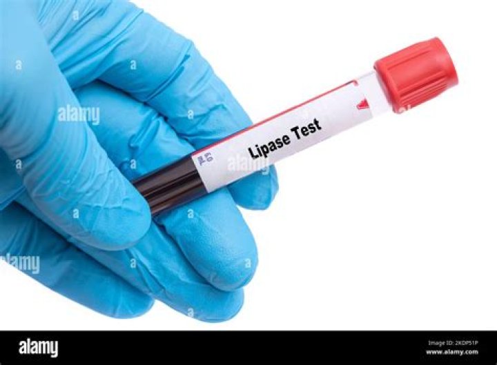 What lipase test for?