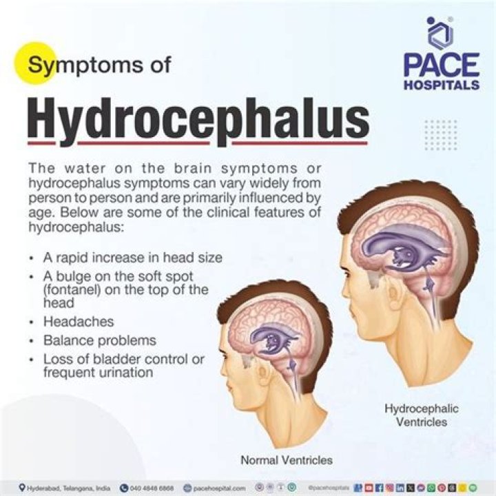 What part of speech is hydrocephalus?