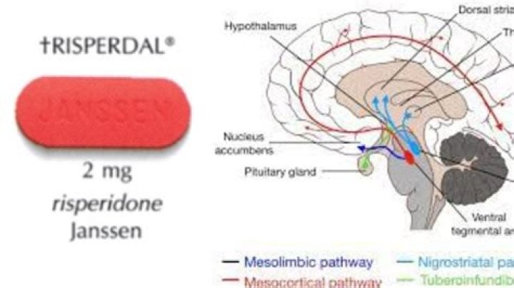What risperidone does to the brain?