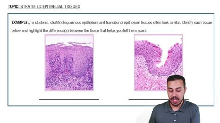 What stratified epithelial tissue?