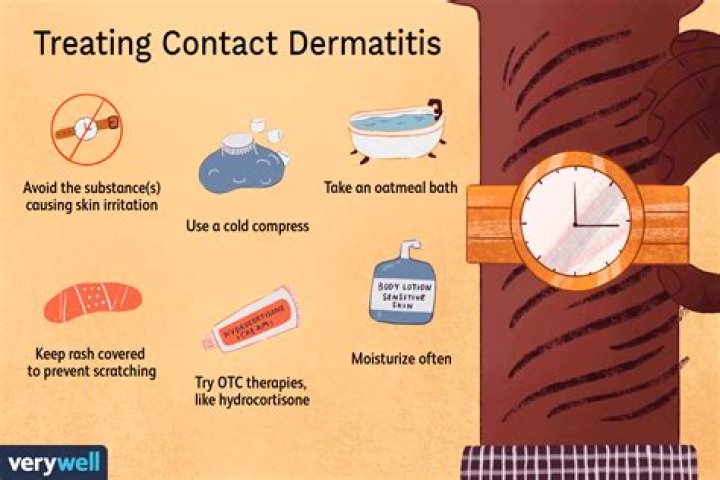 What to do for contact dermatitis?