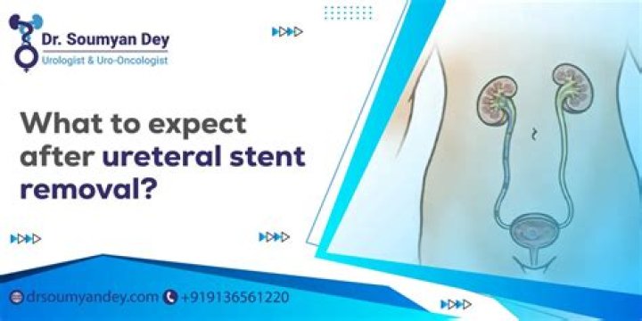 What to expect after pneumonectomy?