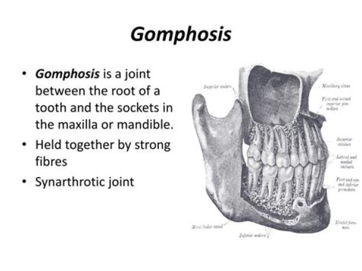 What type of joint is gomphosis?