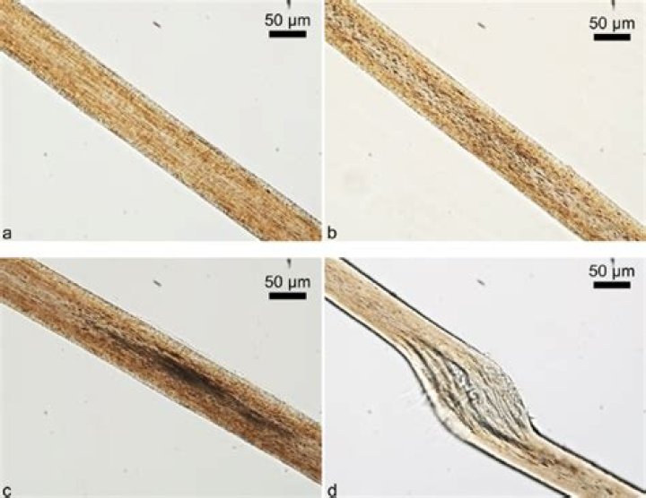Whats a cortical fusi?