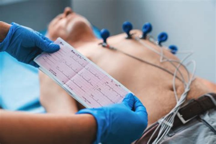 Whats a electrocardiogram test?