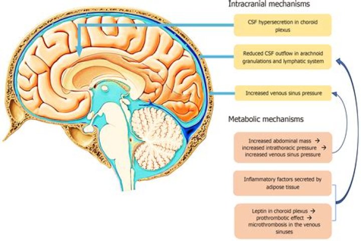 Whats a intracranial process?