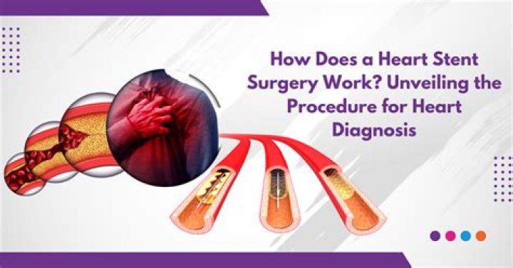 Whats a stent in the heart?