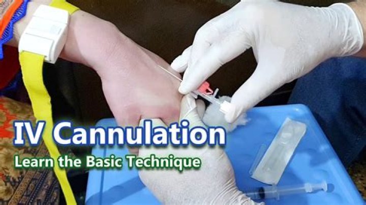 Whats d meaning of cannulation?