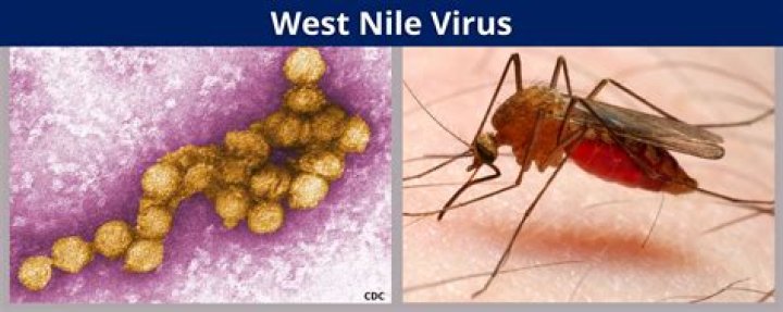 Whats west nile encephalitis?