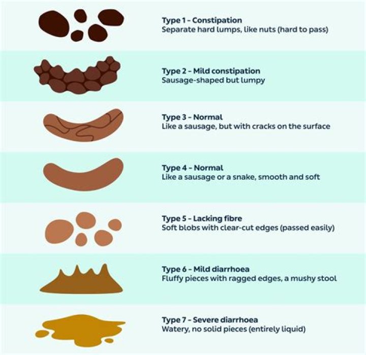 When a poop is too big?