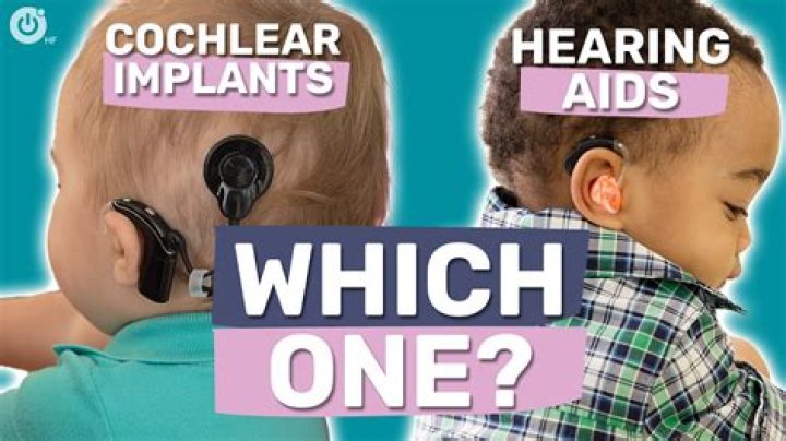 When did cochlear implants become popular?