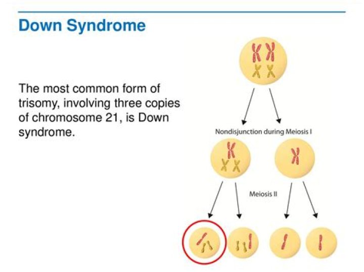 When do trisomies occur?