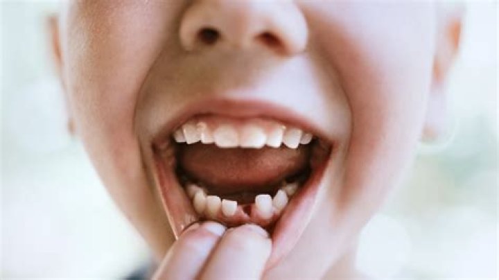When does milk tooth fall?