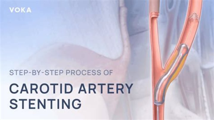 When finding carotid artery?
