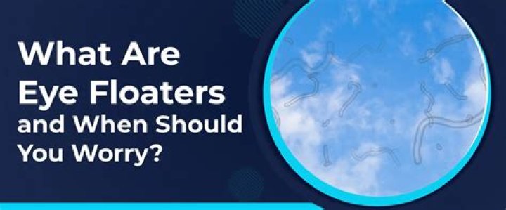 When floaters interfere with vision?
