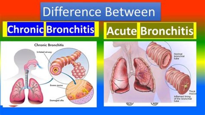 When is bronchiolitis not contagious?