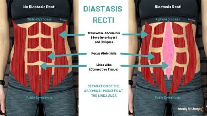 When is diastase used?