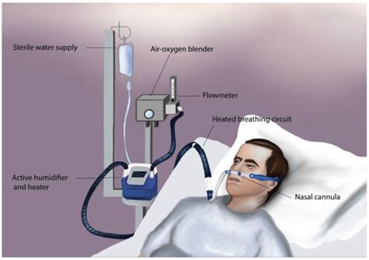 When should a nasal cannula be used?