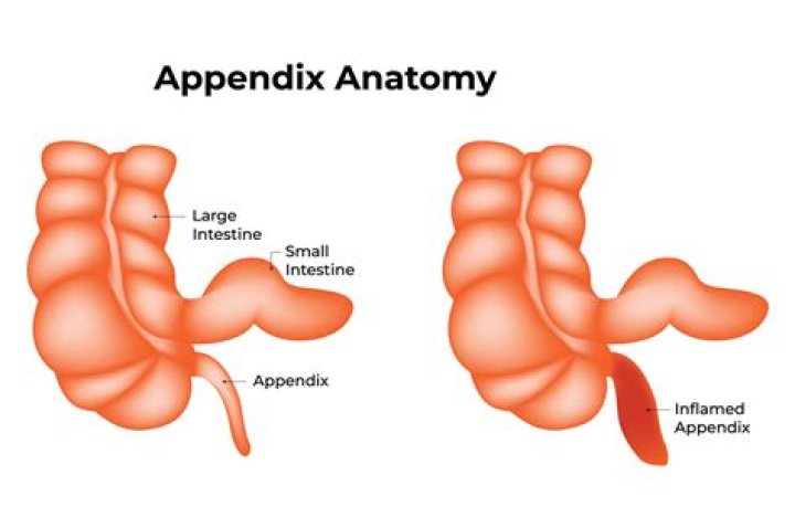 When to use annexure or appendix?