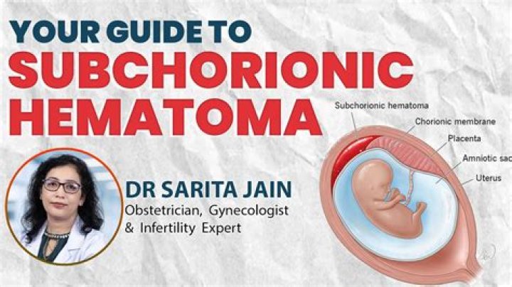 When to worry about subchorionic hematoma?