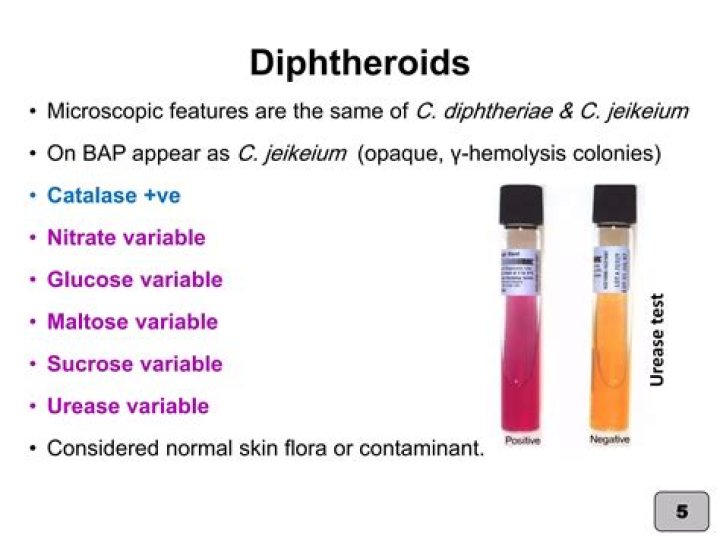 Where are diphtheroids found?