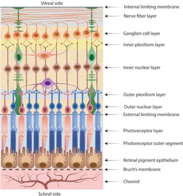 Where are exudates in the retina?