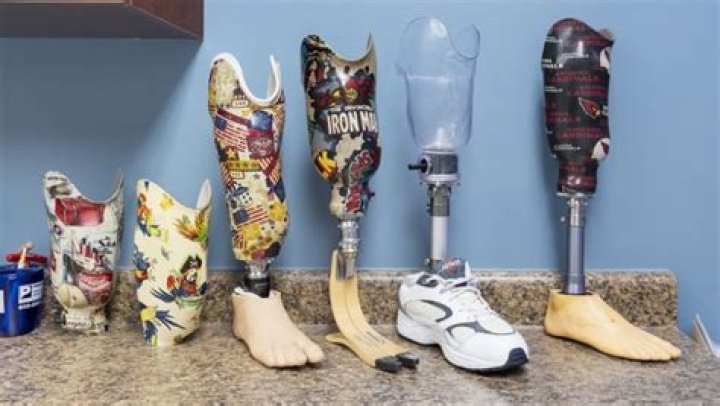 Where are prosthetics made?