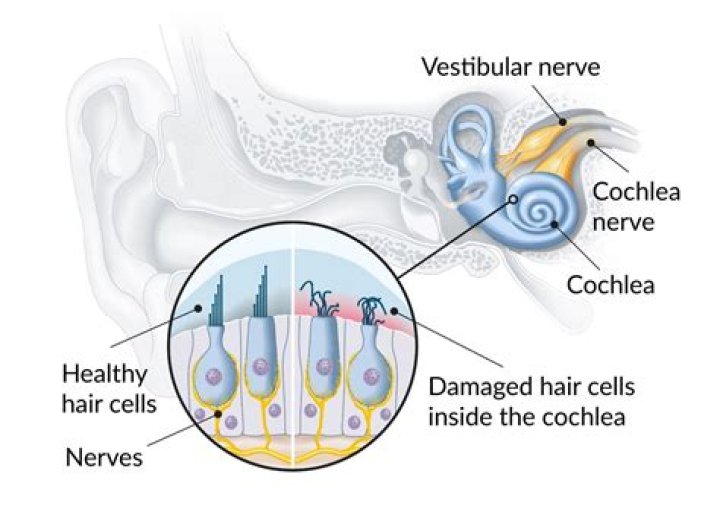 Where are the tiny hairs that are found in the cochlea?