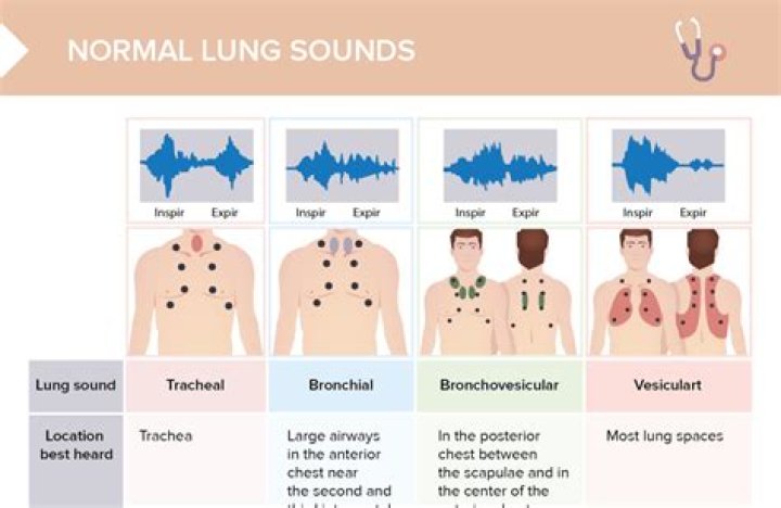 Where are vesicular breath sounds?