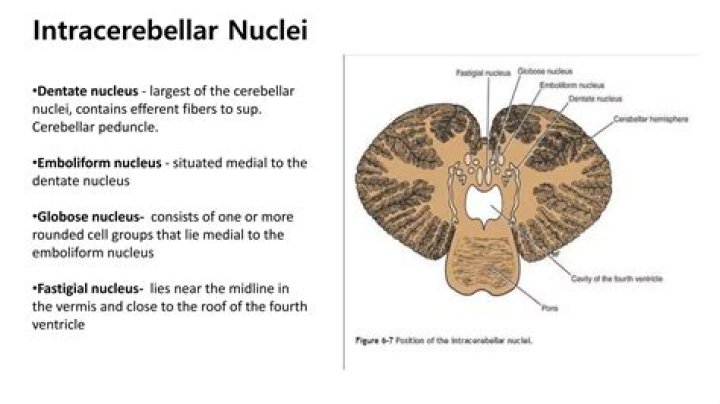 Where can intracerebellar nuclei be found?