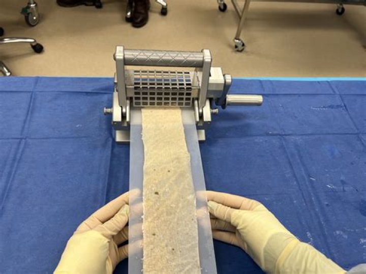 Where do they take skin from for skin grafts?