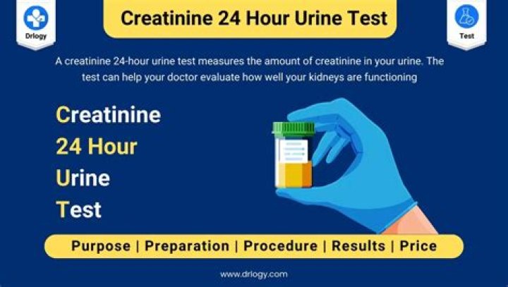 Where does concentra send urine tests?