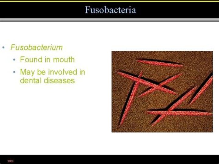 Where does fusobacterium come from?