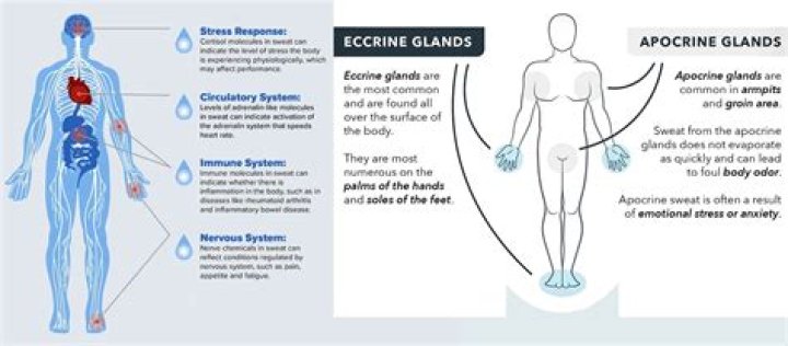 Where does profuse sweating come from?