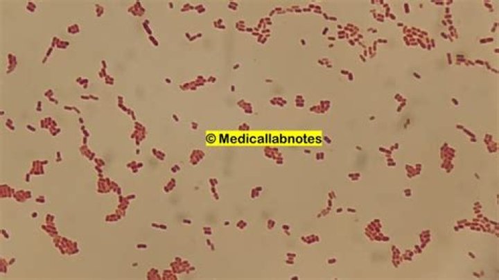 Where does stenotrophomonas come from?