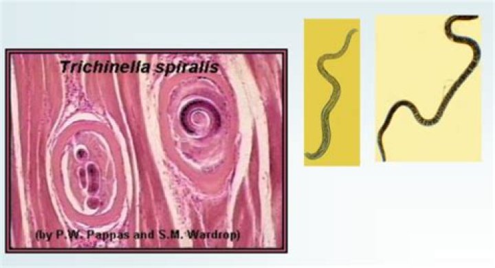 Where does trichinella live?