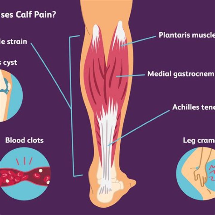 Where is a calf strain?