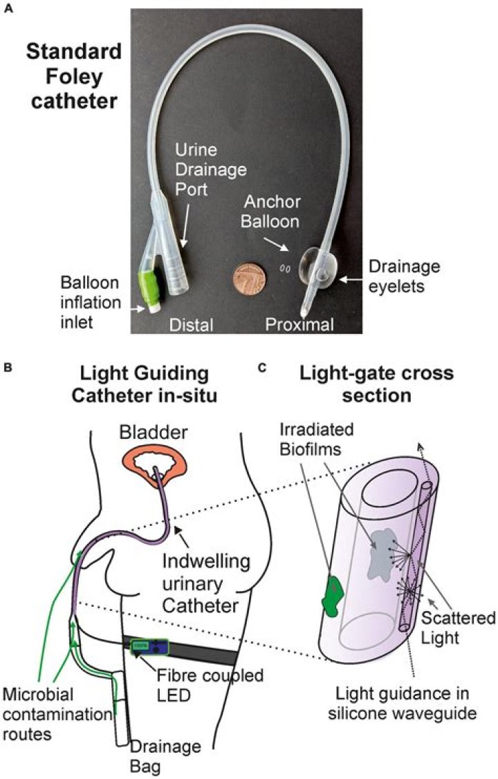 Where is indwelling catheter?