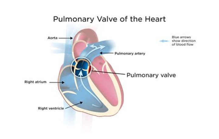 Where is pulmonic valve best heard?