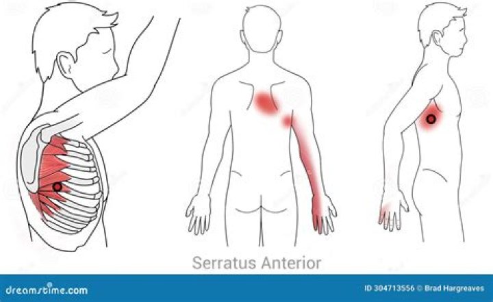 Where is serratus anterior pain?