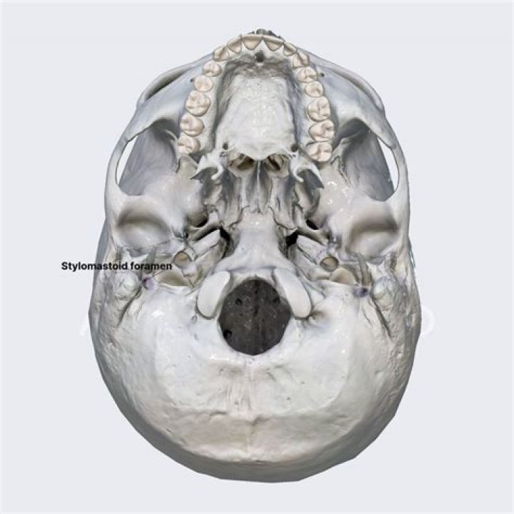 Where is stylomastoid foramen?