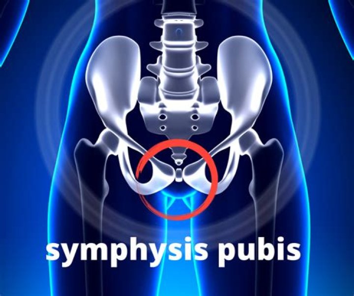 Where is symphysis pubis dysfunction pain?
