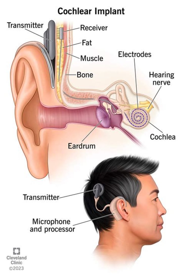 Where is the cochlear microphonic?