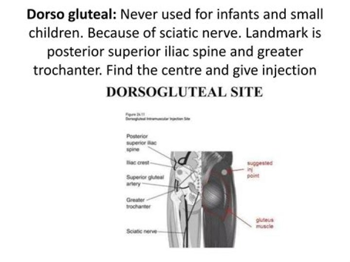 Where is the dorsogluteal site located?