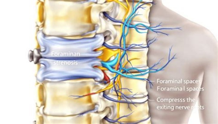 Where is the foraminal area?