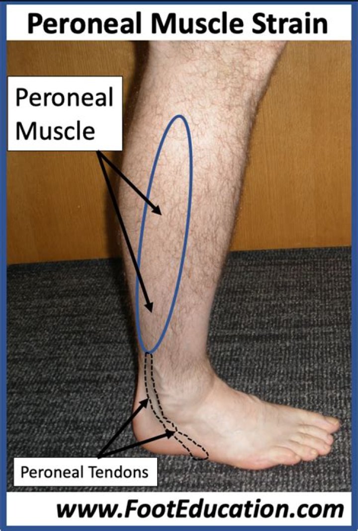 Where is the peroneal muscle?