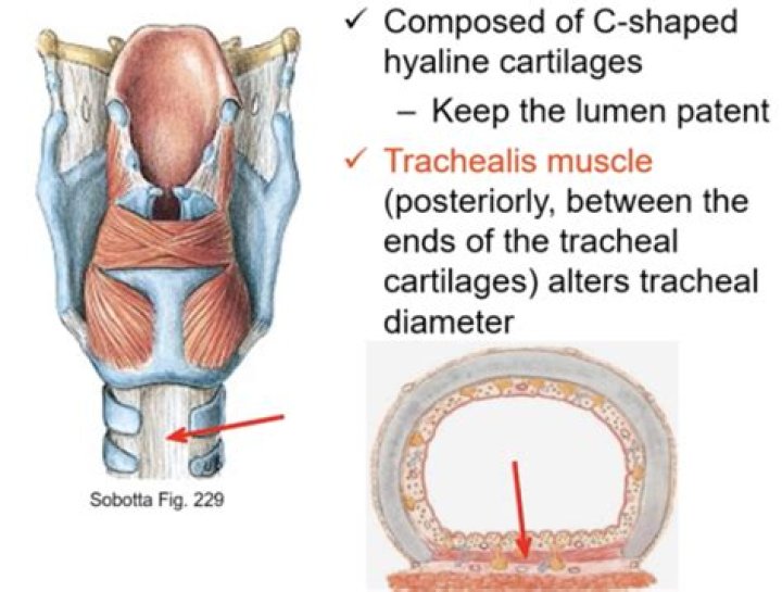 Where is the trachealis muscle located?