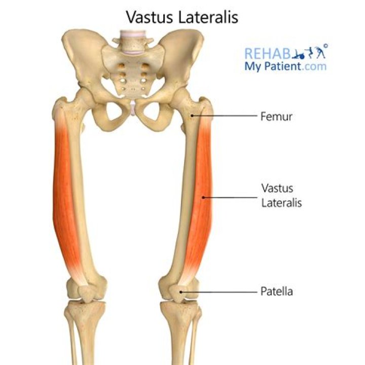 Where is vastus lateralis located?
