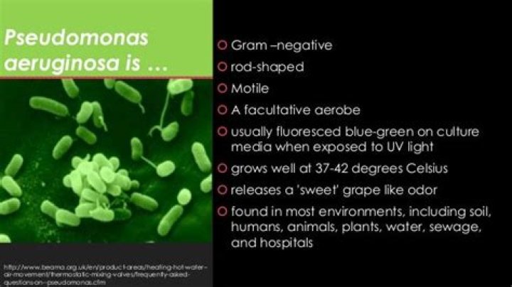 Where pseudomonas aeruginosa can be found?