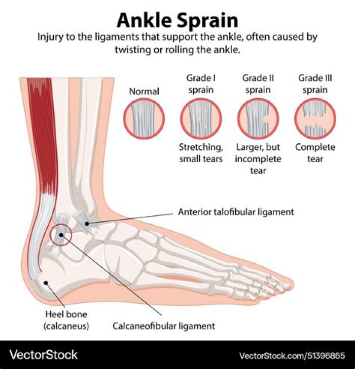 Which ankle to put anklet on?
